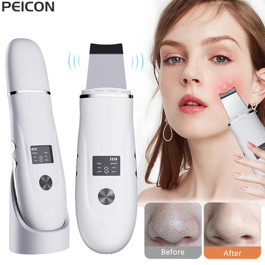 Ultrasonic Face Scrubber